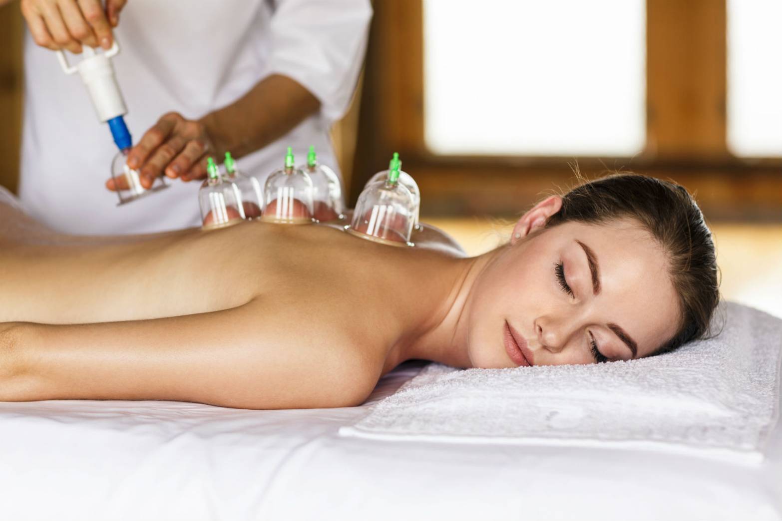 Cupping Therapy by Onnie