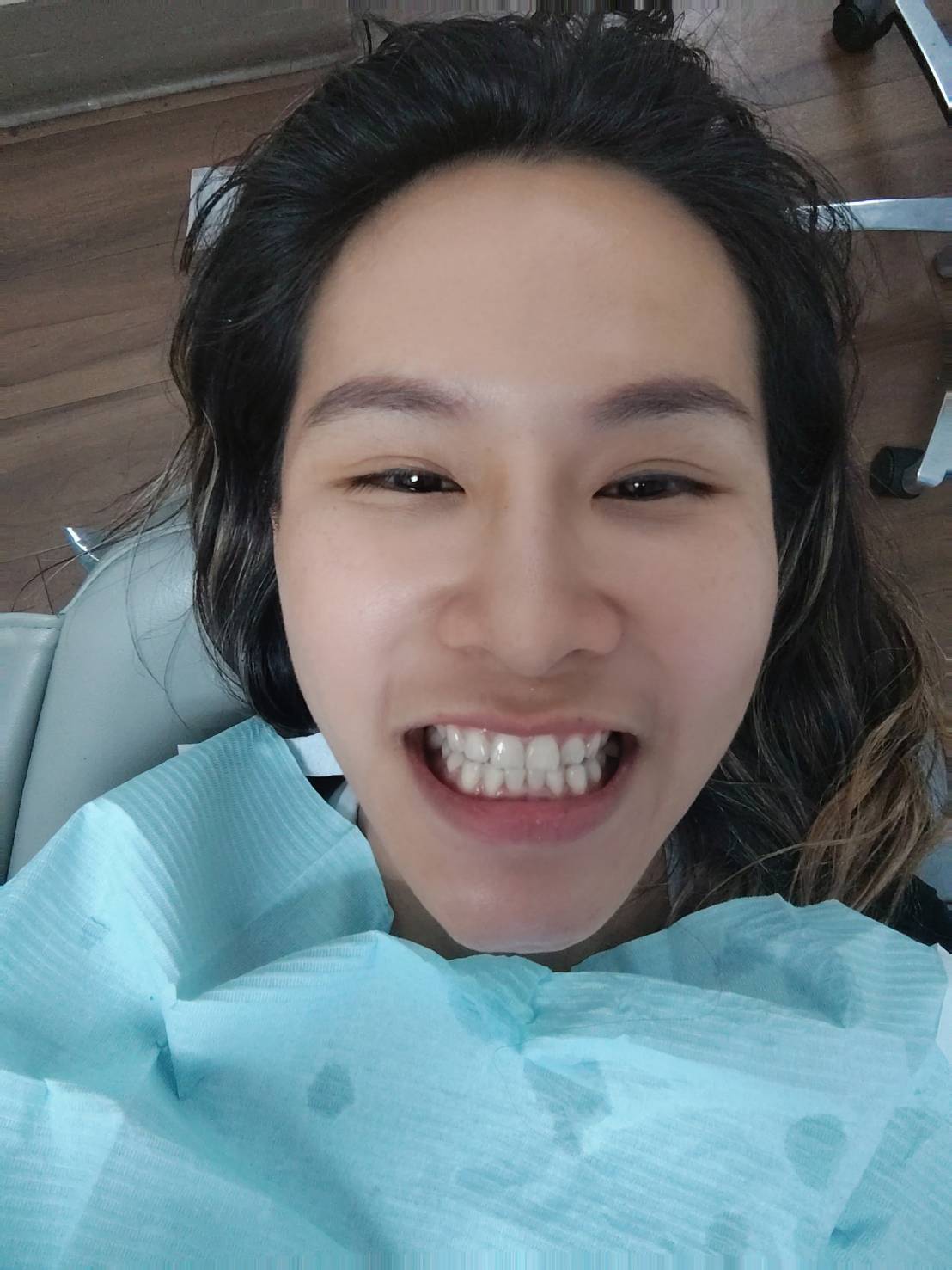 Royal Escape Teeth Whitening
